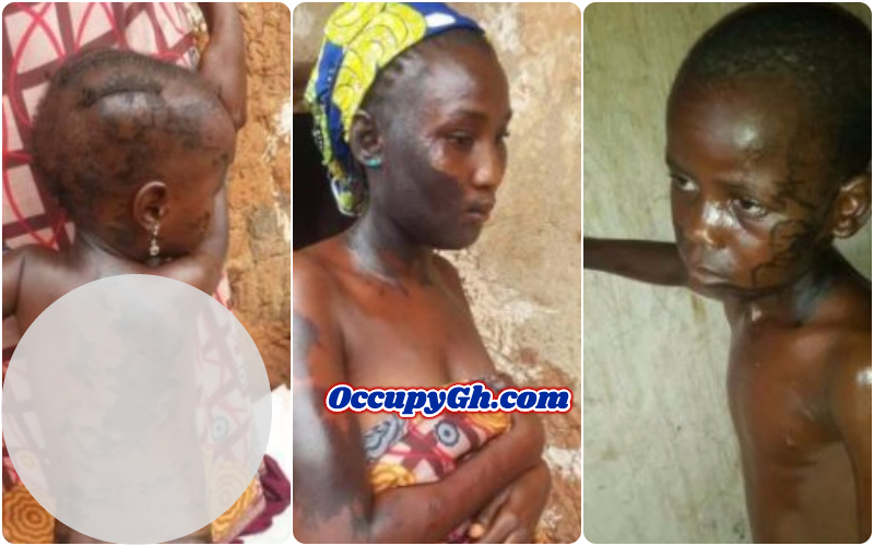 Just In: Man Douses Wife and Kids With Acid