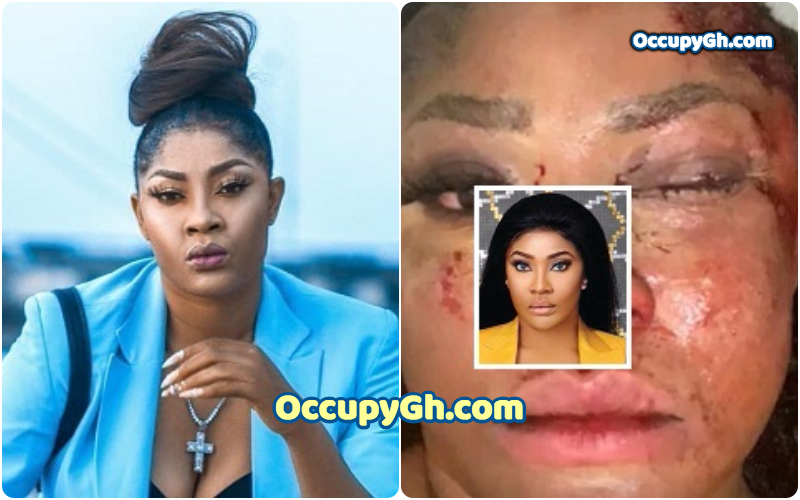 Angela Okorie Shares Moment Bullets Were Removed From Her Face