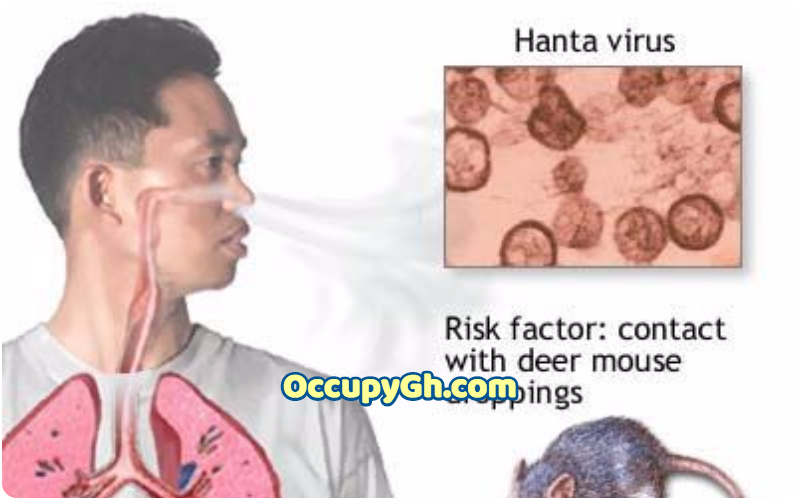 China Records New Virus - Hantavirus