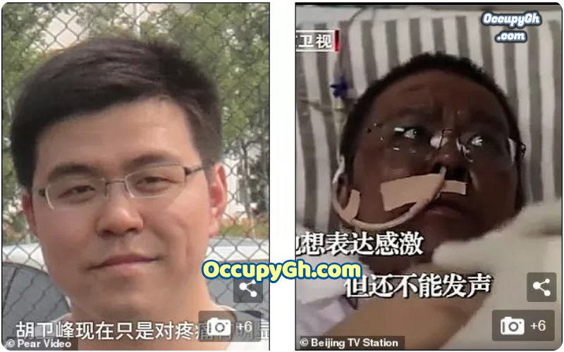 chinese doctor turns black coronavirus treatment