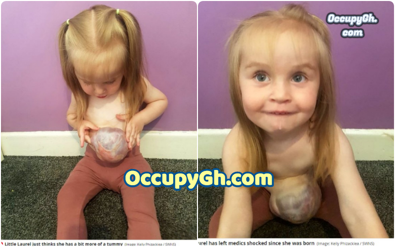 Little Girl with stomach outside body