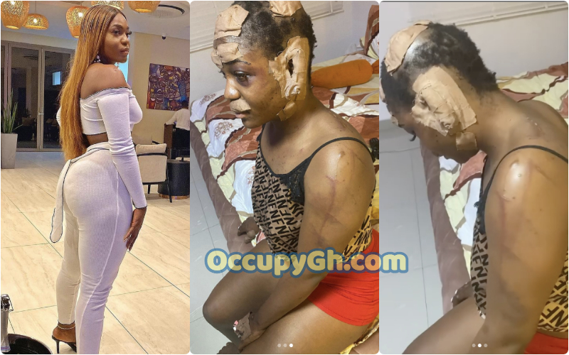 See What Kidnappers Did To A Lady
