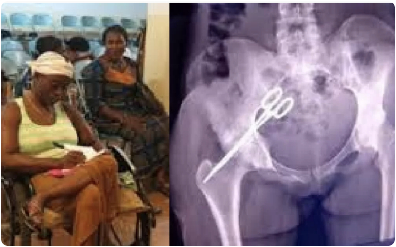woman had scissor in her pelvic