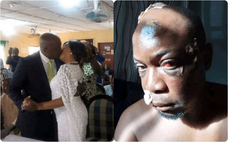 man beaten by wife
