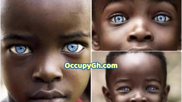 uganda boy with Sapphire eyes