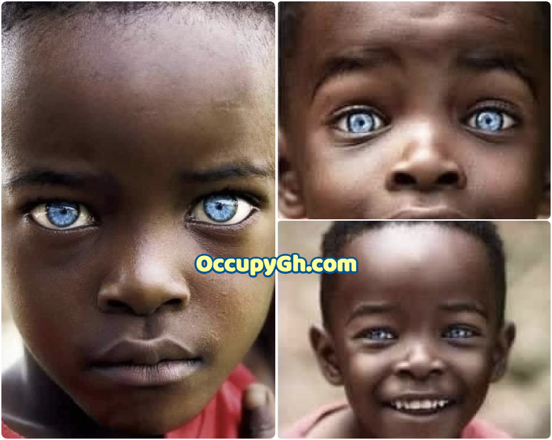 uganda boy with Sapphire eyes
