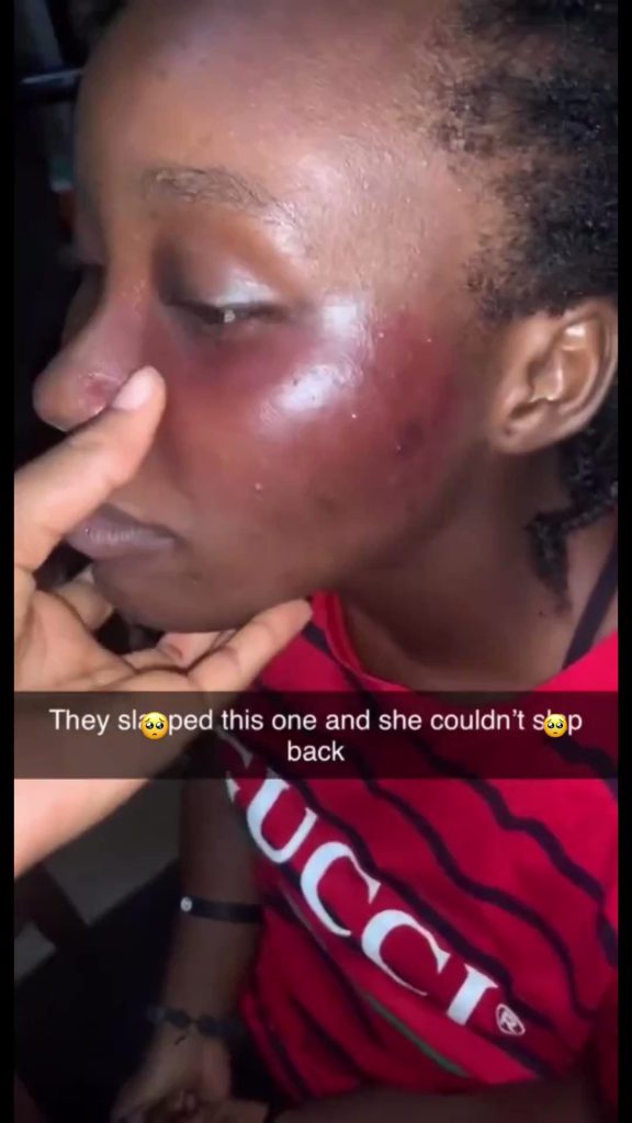 lady slapped by boyfriend