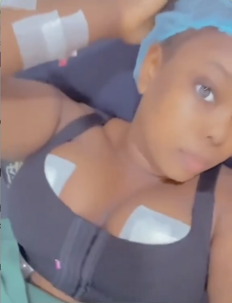 Lady Shares Before and After Brɛαst Reduction Surgery