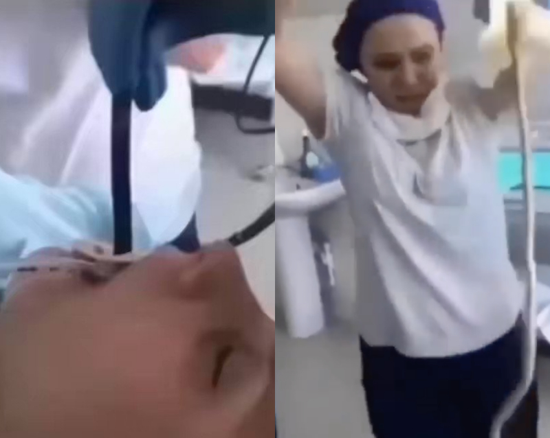 doctor remove snake woman mouth