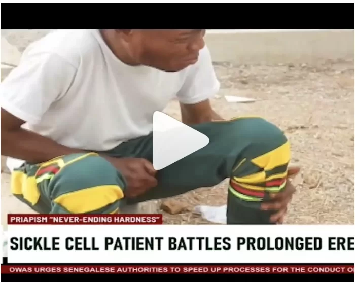 sickle cell patient battles prolong erection