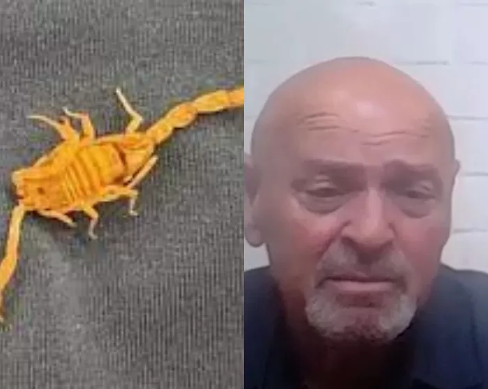 man testicles stung scorpion hotel las vegas