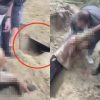 Man Found Buried Alive