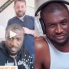 peter okoye hair transplant