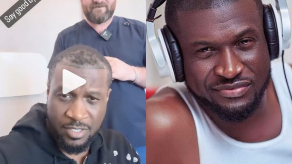 peter okoye hair transplant