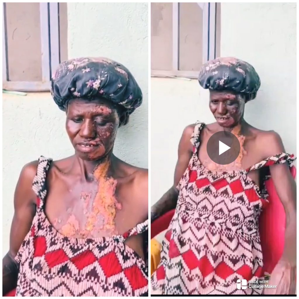 girl burns mother kumasi